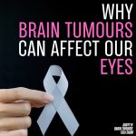 Why Brain Tumours Can Affect Our Eyes