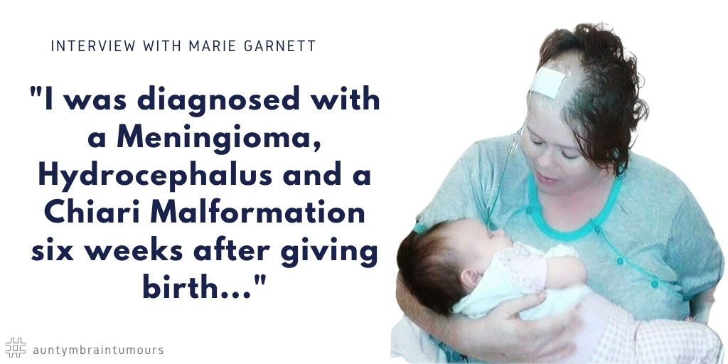 Marie Garnett I was diagnosed with a Meningioma Hydrocephalus and a Chiari Malformation just six weeks after giving birth to my daughter