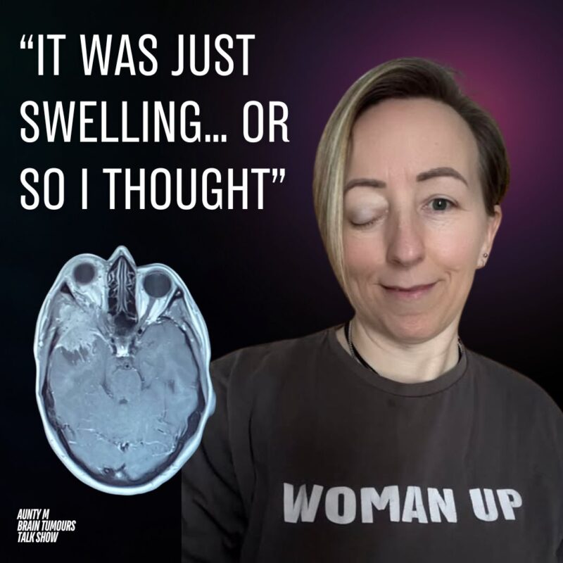 Podcast: My Meningioma Grew Back After Surgery