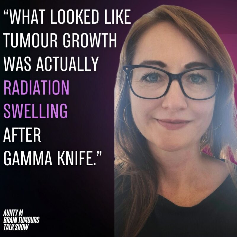 Naomi’s Acoustic Neuroma (vestibular schwannoma) Story