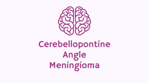 cerebellopontine angle meningioma stories