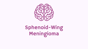 sphenoid-wing-meningioma