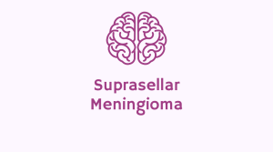 suprasellar meningioma stories
